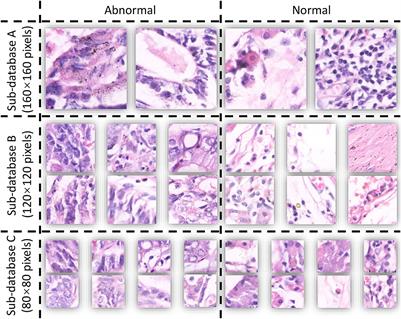 A comparative study of gastric histopathology sub-size image classification: From linear regression to visual transformer